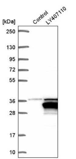 LRRC57 Antibody, Novus Biologicals:Antibodies:Primary Antibodies